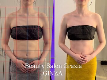 グラツィア 銀座(Grazia)/6回【 ブライダルエステ整体 】