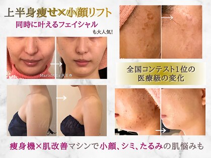 マリスステラ 天王寺(MarisStella)の写真