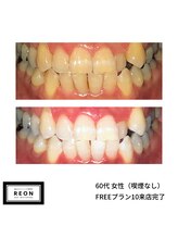 レオン 磐田(REON)/◇ お客様 before＆after ◇