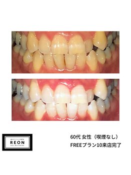 レオン 磐田(REON)/◇ お客様 before＆after ◇