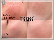 ティーズキッス(T’s Kiss)