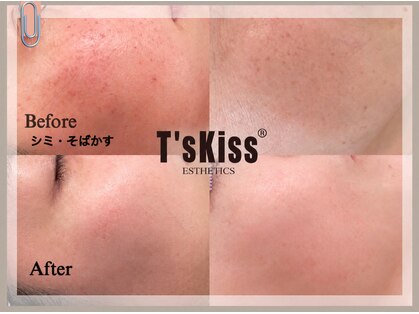 ティーズキッス(T’s Kiss)の写真
