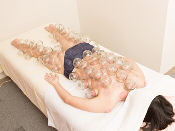 足浴堂/カッピングで一気に疲れをとる♪