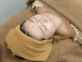 中島整骨院 鍼灸院 整体院/美容鍼