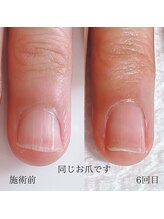 メイル(MEILU)/自爪育成