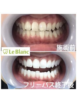 ルブラン 奈良店(Le Blanc)/歯のケアされてますか？