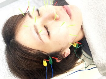 池袋東鍼灸整骨院/美容鍼+電気パルス