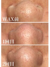 ビーラボ(Be-Lab.)/オプションで小鼻ワックスも！！