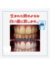 ホワイトニングショップ 千葉店/歯科提携　ホワイトニング専門店