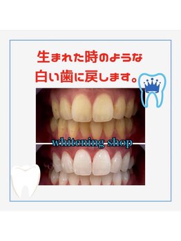 ホワイトニングショップ 千葉店/歯科提携　ホワイトニング専門店