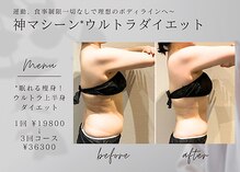 ロッタ エクリュ(Lotta ecru+)