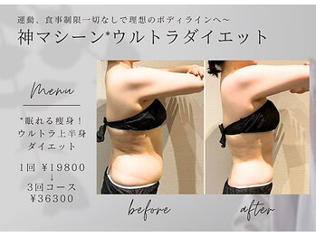 ロッタ エクリュ(Lotta ecru+)