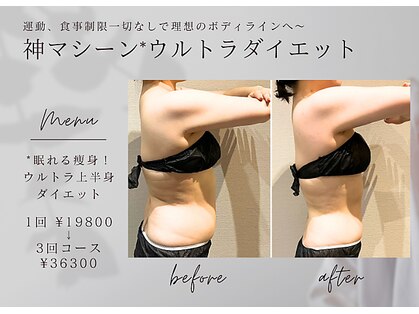 ロッタ エクリュ(Lotta ecru+)の写真