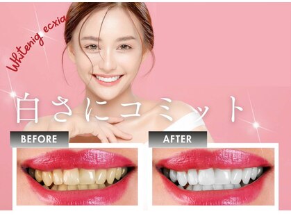 エクシアホワイトニング 六本木店の写真