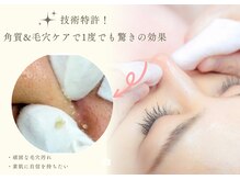 リリーガーデン(Lily Garden)