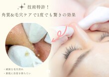 リリーガーデン(Lily Garden)