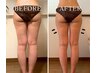 【美脚コース】セル脂肪を徹底分解!下半身痩せはコレ！￥11000→￥6800 100分