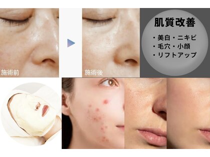 クレール グラン エステの写真