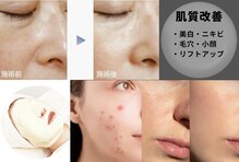 クレール グラン エステ