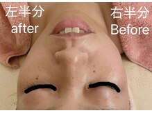 シャインクラフトの雰囲気（お肌のお悩みに応じてフェイシャルメニューのご提案をします）