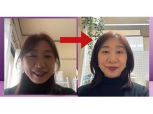 ヨサパーク ヴィヴァン(YOSAPARK Vivant)/むくんだ顔もスッキリ小さく！