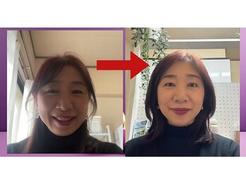 ヨサパーク ヴィヴァン(YOSAPARK Vivant)/むくんだ顔もスッキリ小さく！