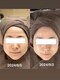 ギンザ リボーン(Ginza Reborn)の写真/【ハリツヤUPで水光肌へ♪】お悩みを徹底改善☆お肌の内側から潤いを与えて憧れのツヤツヤ肌になれる◎
