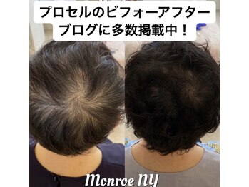 ネイルズアオアクア(Nail's AO AQUA)/話題のプロセルセラピー