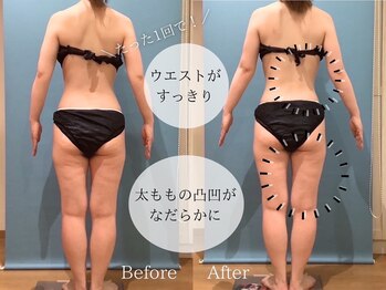 ピュアエステ ブリアント 松戸店/お客様の結果［松戸］