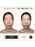 人気【本気の小顔♪】最新機器で脂肪☆分解☆即効小顔　　￥22000