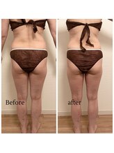 ヨサパーク リコア(YOSA PARK Likoa)/beforeAfter