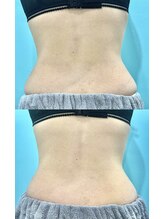 カンナムビューティー/オンダリフト/表参道/ララピール