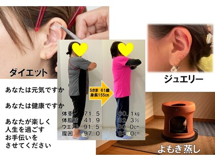 ブルーローズの写真