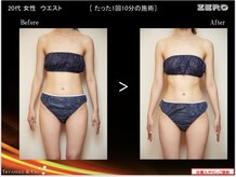 アンレーヴ(Un Reve)