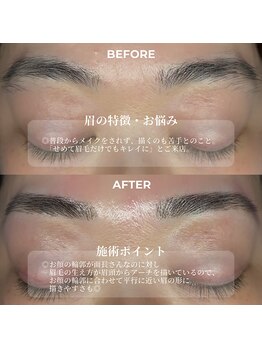 クリル(Kuril)/ビフォーアフター40代女性♪