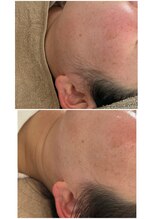 リノ(Lino)/もみあげスッキリが人気！