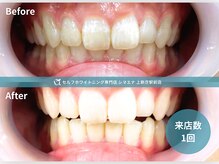 シマエナ 上新庄駅前店の雰囲気（1回でも実感！上新庄駅前のセルフホワイトニング◎）