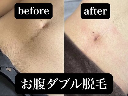 エーベース 横浜店(A-BASE)の写真