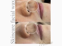 ルーナ(Runa)/■スキンケアフェイシャルWAX