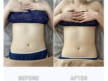 アランシア(Arancia)/