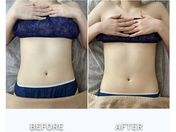 アランシア(Arancia)/