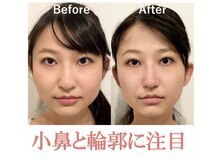 隆鼻矯正専門店 ラプリエイル 千葉店(Raplit aile)の雰囲気（日本隆鼻矯正協会認定サロンにしかできない高技術!鼻/小顔矯正/）