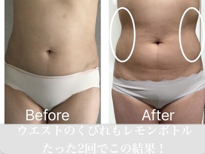 ニュイブラーシュ(nuit blanche)の写真