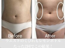 ニュイブラーシュ(nuit blanche)