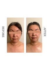 ワン ストレッチ(ONE stretch)/【フェイシャル】