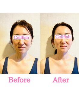 セルフィッシュ(Cellfish)/小顔×美容整体
