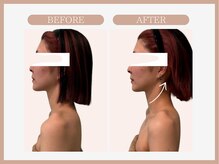 アコガレコガオ 仙台店/