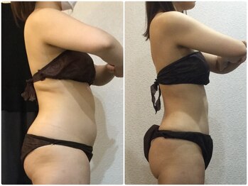 美容整体ウェリナ あま甚目寺院/小顔矯正/骨盤矯正/美脚サロン