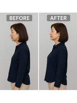 ゆうしん整骨院 ひばりヶ丘/姿勢の変化のイメージ2