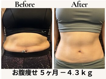 レガリス(REGALIS)/before/after ウエスト